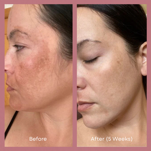 Mascarilla facial LED para una piel radiante