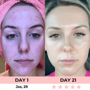 Dermalux - Escultor Facial LED 7-en-1