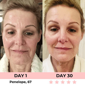 Dermalux - Escultor Facial LED 7-en-1