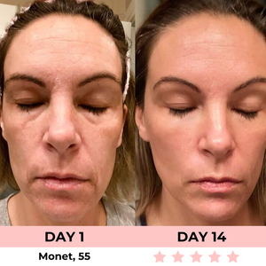 Dermalux - Escultor Facial LED 7-en-1