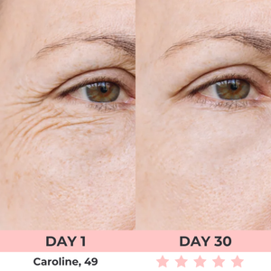 Dermalux - Escultor Facial LED 7-en-1