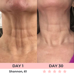 Dermalux - Escultor Facial LED 7-en-1