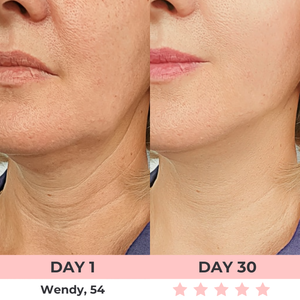 Dermalux - Escultor Facial LED 7-en-1